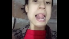 Boulogne fisura Thumb